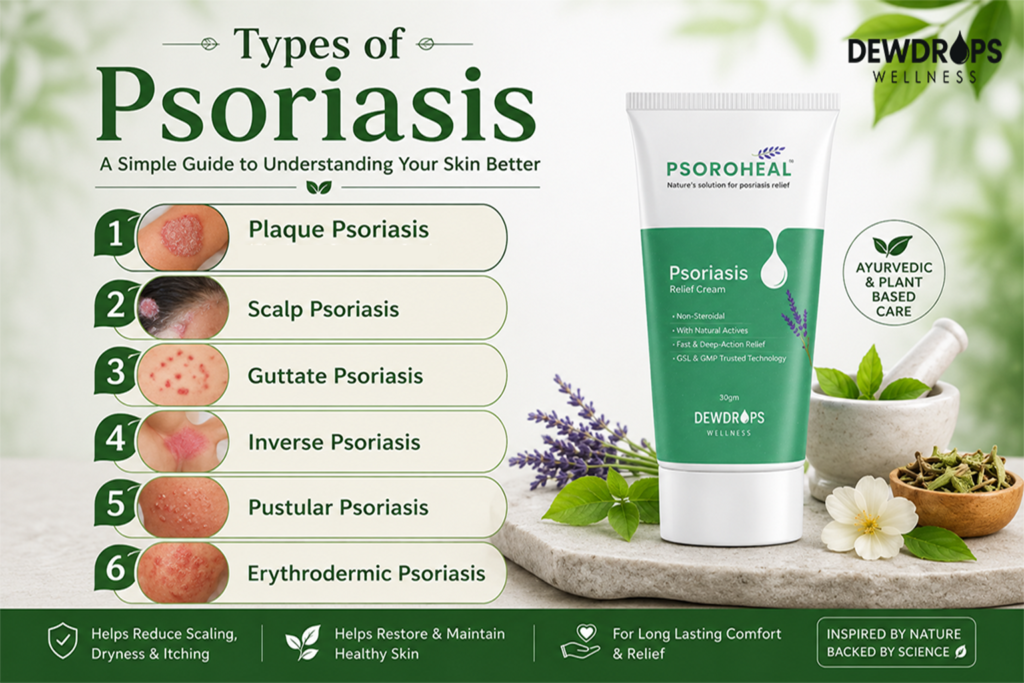 Types of Psoriasis – Plaque, Scalp, Guttate, Inverse, Pustular and Erythrodermic Psoriasis with Psoroheal Ayurvedic Relief Cream
