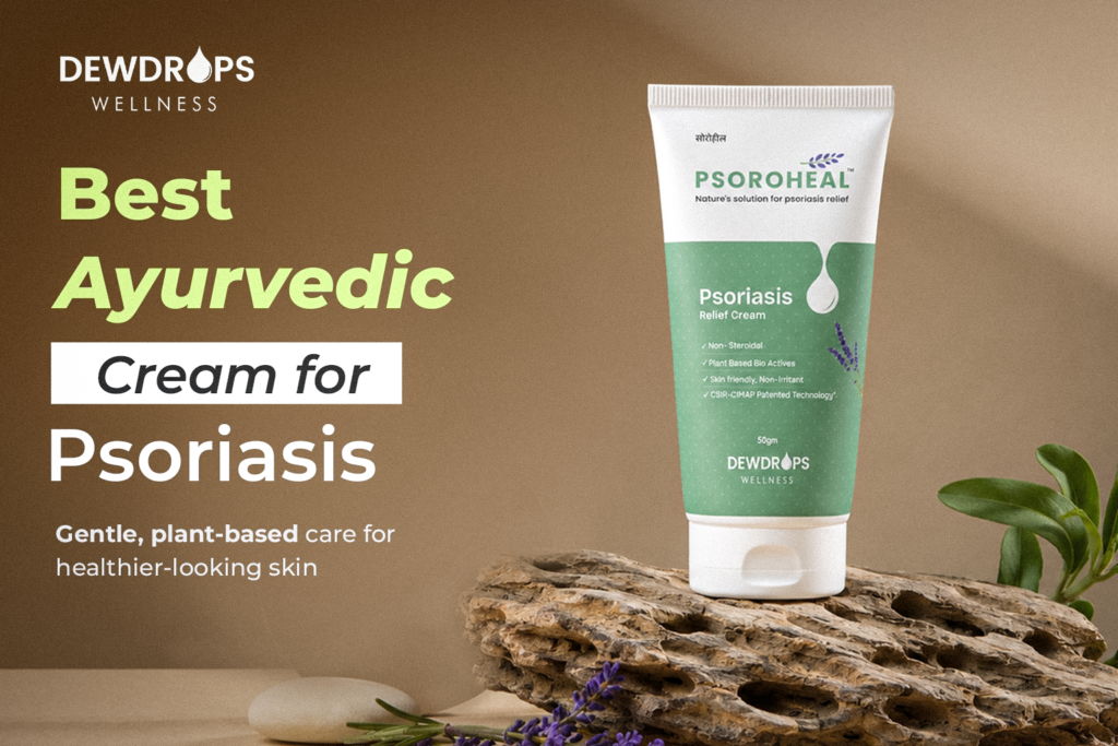 Psoroheal Ayurvedic cream for psoriasis by Dewdrops Wellness