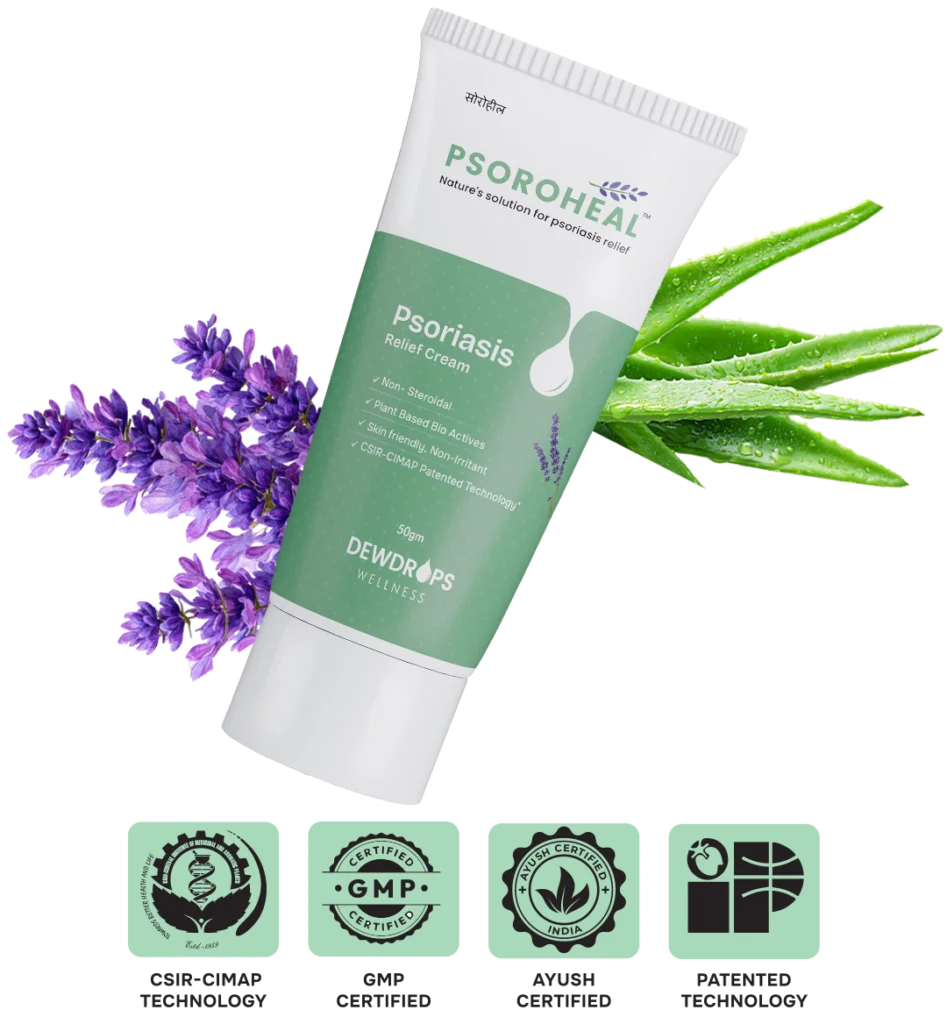 Psoriasis symptoms — redness, scaling, itching — managed with Psoroheal