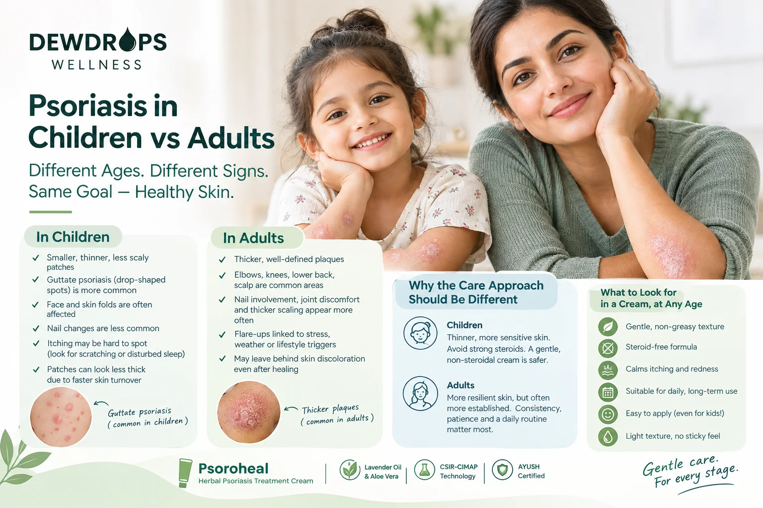 Psoriasis in children vs adults showing symptoms, affected skin areas, and gentle care approaches
